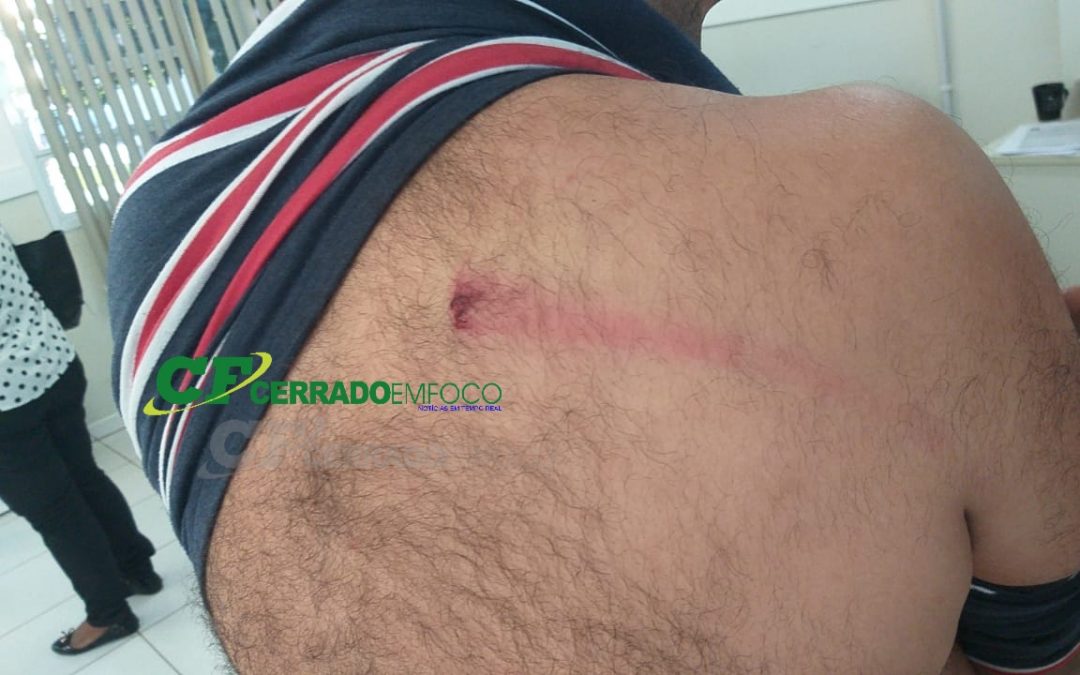 LEM: Pedinte agride esposo de pastora